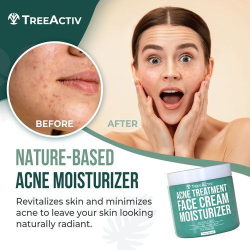 TreeActiv Salicylic Acid Face Moisturizer, 2 fl oz, Acne Treatment Face Cream for Oily Skin with and Tea Tree Oil, For Teens and Adults with Acne Prone Skin and Cystic Acne, 90 Day Supply