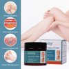 jeosisy Varicose Vein Cream - Varicose Veins Cream for Legs, Varicose & Spider Veins Soothing Leg Cream (light blue, 50g)