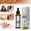 Rosemary Oil for Hair Growth, Hair Growth Serum, Rosemary Essential Oil for Reducing Hair Loss, Nourishing Hair Oil For Dry Itchy Scalp, Hair Strengthening Oil For Men And Women 1.69Oz