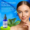 Skin Perfection Copper Peptides Serum for Face & Hair - Youth Serum with Copper Peptide for Fine Lines & Wrinkles - 1% Blue Liquid for Face, Hair, Body, and Scalp