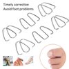Ingrown Toe Wire Fixer, Nail Corrector Ingrown Toe Nail Wire Lifter Fixer Recover Tool Kit Toenail Correction Pedicure Tool Bunion Corrector Set for Pedicure Foot Care Men Women