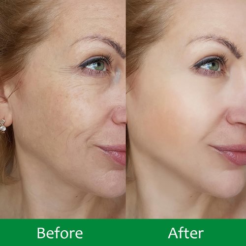 IREV 10 Pack Hydrating Face Masks, Anti Aging Face Sheet Masks,Instant Brightening & Moisturizing & Repairing Face Sheet Mask with Hyaluronic Acid, Ceramide, Face Masks Skincare, Spa Face Masks