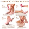 Yaya Callus Remover for Feet - Extra Strength - Vitamin E + Moisturizing Effect - Foot Scrubber File and 5 Pink Latex Gloves - Callus Remover Gel 8OZ - Foot Spa Kit