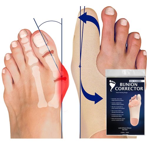 Bunion Bootie - Bunion Corrector for Women - Effective, Ultra-Thin Big Toe Straightener for Day & Night Comfort, Wearable with Shoes, Comfortable Bunion Socks for Correction - Small-Left