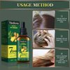 Vedora King of Ginger Oil for Hair Growth - Biotin Hair Growth Serum, 100% Pure Natural Ginger Essential Oil - Promotes Stronger, Thicker, Longer Hair in Women & Men - 3.15 Fl Oz / 90ML (3 PCS)