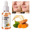 2 Pack Turmeric Serum for Dark Spots, Turmeric Dark Spot Corrector Serum for Acne, Hyperpigmentation and Smooth Skin, Formulated with Hyaluronic Acid, Vitamin C & E - 1.01 FL.OZ