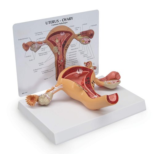 GPI Anatomicals - Uterus and Ovary Model, Model of Female Reproductive System for Human Anatomy and Physiology Education, Anatomy Model for Doctor's Office and Classrooms, Medical Learning Resources