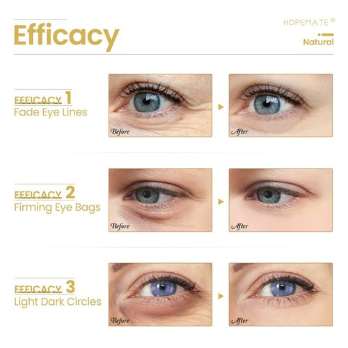 HOPEMATE Eye Cream for Dark Circles, Puffiness, and Wrinkles, Improves and Firms eye Skin for Youthful, Refreshed Eyes-Pure Natural Material Extraction