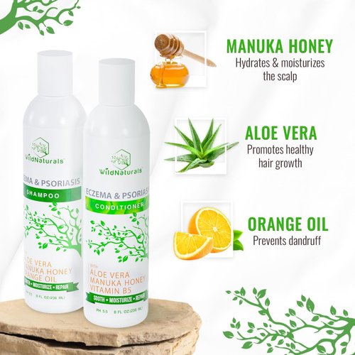Eczema Psoriasis Shampoo & Conditioner Set for Men & Women - Anti Dandruff Shampoo for Dry Scalp & Hair - Seborrheic Dermatitis Shampoo for Itchy Scalp Treatment - Eczema Shampoo for Scalp Psoriasis