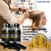2pcs Ultra Hold Hair System Adhesive 3.4oz w/ 2pcs Hair Sectioning Clip Bundle Pack | Waterproof Invisible Long-Lasting | Front Bonding Weave Toupees Wigs Extensions Lace Wig Glue | Bold Hold Adhesive