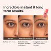 NAPH iNNBEAUTY PROJECT Bright & Tight Dark Circle Firming Eye Cream with Vitamin C & Peptides (0.5 oz / 15 mL) + Bonus Acne Patch (36 Pieces)