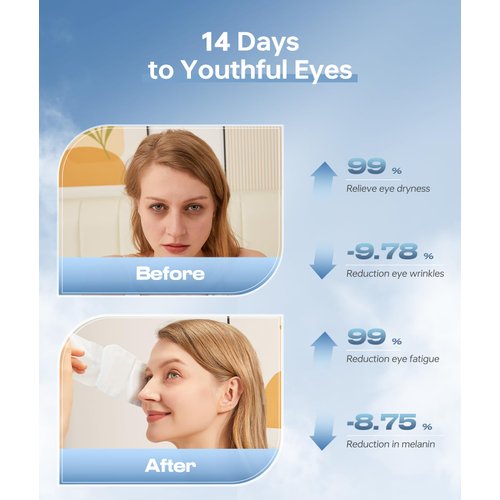 ZHENYEMEI Hyaluronic Acid Self Heating Warm Compress for Eyes, Heated Eye Mask for Fast Relief of Dry Eyes, 7 Pack Steam Eye Mask, Moisturizing & Highly Effective Steam Eye Mask