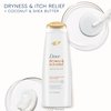 Dove DermaCare Scalp Anti Dandruff Shampoo Dryness and Itch Relief for Dry and Itchy Scalp Dry Scalp Treatment with Pyrithione Zinc 12 fl oz