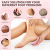 BALUCA Glass Foot File Callus Remover, Heel Scraper Shower Foot Scrubber for Dead Skin Remover, Nano-Glass Egg Pumice Stone Pedicure Foot Buffer - Pink