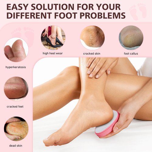 BALUCA Glass Foot File Callus Remover, Heel Scraper Shower Foot Scrubber for Dead Skin Remover, Nano-Glass Egg Pumice Stone Pedicure Foot Buffer - Pink