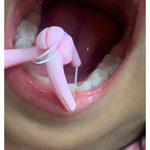 YaPoola Reusable Dental Floss Handle for Adults and Kids Reusable Dental Floss Holder Flosser 1 Counts