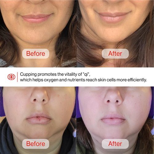 Rena Chris Facial Cupping Set & Gua Sha Facial Tool |Silicone Cupping Set & Rose Quartz Gua Sha Stone |Face Cupping Therapy Set for Natural Anti-Aging, Cellulite, Puffiness, Lip Plumping, Skin Care