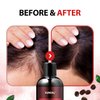 KUNDAL Cherry Blossom CAFFEINE ANTI-HAIR LOSS SHAMPOO Scalp Care Deep Cleansing 10.14 Fl Oz
