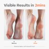 Modelones Nano Glass Foot File - Professional Foot Scrubber and Callus Remover, Heel Scraper for Cracked Heels, Dead Skin Remover, Foot Buffer for Soft Feet, Safe Pedicure Tool with Anti-Slip Handle