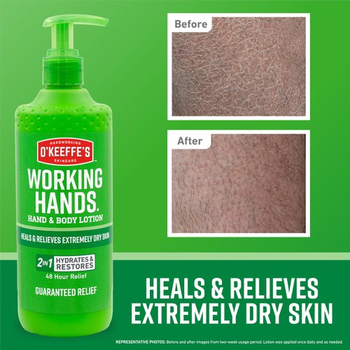 O'Keeffe's Working Hands Hand and Body Lotion, 12oz Pump (Pack of 1) - Heals and Relieves Extremely Dry Skin