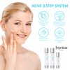 FP Skin Frankie for Acne 3 Step Skin Care Set - Charcoal Face Wash, Salicylic Acid Exfoliator, Niacinamide Moisturizer - 60 Day Supply
