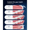 MORNWELL Water Flossers for Teeth 270ML Integrated Water Tank with LCD Display 4 Modes 6 Jet Tips USB Rechargeable Water Teeth Cleaner Pick for Home Travel