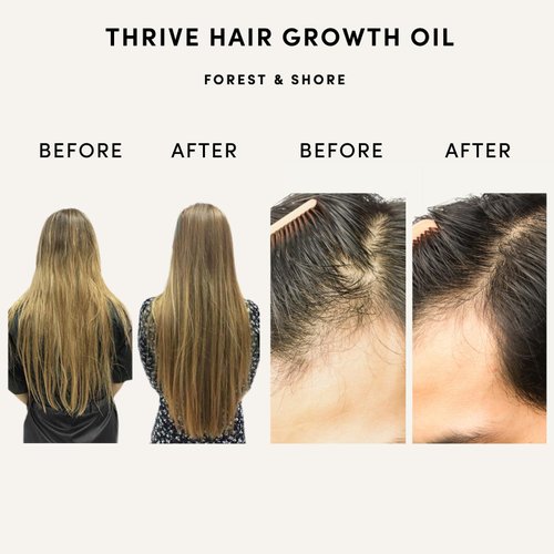 Hair Growth Oil 100% Natural with Caffeine, Biotin, Castor Oil, Argan Oil, Coconut Oil, and Rosemary Oil for Effective Hair Thickening Hair Mask & Hair Loss Treatment (Hair Growth Oil, 100ml)