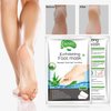 Foot Peel Mask 3 Pack， Exfoliator Peel Off Calluses Dead Skin Callus Remover，Baby Soft Smooth Touch Feet-Men Women (Aloe Vera)
