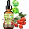 Botanical Beauty ORGANIC ROSEHIP SEED OIL Pure For Face, Skin, Hair and Body. Anti-Aging Moisturizer Facial Oil 2 Fl oz 60 ml