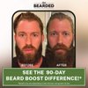 Live Bearded: Beard Boost - Beard Hair Growth Multivitamins with Biotin 10,000mcg, Vitamin C, Vitamin E and Zinc - 30-Day Supply - Thick, Strong, Full Beard Growth Support - Made in the USA