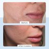 First Aid Beauty Ultra Repair Cream Intense Hydration Moisturizer for Face and Body – Rich Whipped Texture Strengthens Skin Barrier + Instantly Relieves Dry, Distressed Skin + Eczema – 6 oz