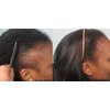 Infinix Scalp & Hair Treatment Pack-Black Seed Oil-Thick and Full & Biotin Infused-Finishing, Repair and Soothing - For irritated, Itchy Scalp - For Hair growth - Pack of 2