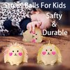 Hedgehog Stress Balls for Adults Squishy Toys (1PCS) Autism Sensory Toys Stress Ball, Fidget Toys for Kids Dough Ball, Party Favors Animal Toys Sensory Balls, Sensory Toys for Autistic Children (Pink)