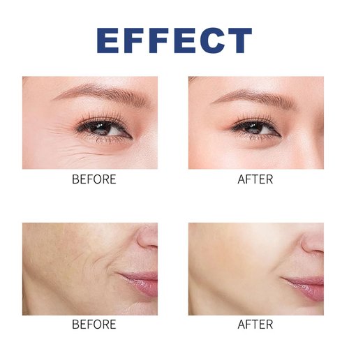 YUANLI Collagen Face Mask, 5 Pack Deep Collagen Overnight Mask, Collagen Face Mask Deep Collagen Anti Wrinkle Lifting Mask, Overnight Face Mask for Elasticity, Firming and Moisturizing - 1 Fl.oz x 5ea