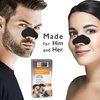 Global Beauty Care Premium 18 Nose Cleansing Strips of Activated Charcoal & Vitamin C Nose Strips For Blackheads Removal Charcoal Blackhead Remover Strips - 18 Ct