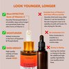 Ayurvedic Vitamin C Oil - Skin Brightening Vit C Serum with Rosehip Oil, Ashwagandha, Squalane - Hydrating Face Oil - Non-Greasy Facial Oil - Pure Vitamin C Oil - Luxury Skin Care Products - 30ml