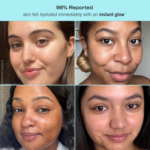 First Aid Beauty Brighten + Glow Moisturizer – Light Gel Cream Moisturizer with Vitamin C, Brightens for an Instant Healthy Glow – 1.7 oz.