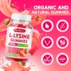 L-Lysine 1000mg Gummies, Lysine Supplement for Adults & Kids, Essential Amino Acid Supplement for Oral & Lips Health, Boost Immune & Calcium & Collagen, Sugar-Free, Strawberry Flavor, 60 Count