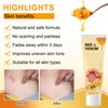 New Bee Venom Treatment Cream, Bee Venom Professional Gel, Professional Bee Venom Repair Cream, Soothing Provides for Neck, Waist, Back, Hand Feet, and Leg (2 Pcs)