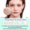 156 Patches Acne Patch Colorful Hydrocolloid Pimple Patch with Natural Tea Tree Oil, Cute Star and Love Heart Shaped Acne Absorbing Cover Patch Kit for Face Zits, Pimples, Blemishes, Spots Acne Dots