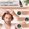 Rosemary Oil for Hair Growth (2oz) with Cold Pressed Castor Oil - Live Fraiche Natural Hair Growth Oil - Rosemary and Castor Oil for Hair Growth -Strengthening Hair Oil for Damaged Hair and Hair Loss