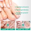 3PCS Kerassentials Toenail Treatment Oil, Natural Kerassentials Toenail Oil for Nails, Kerasentials Toenail Nail Treatment for Repairing Damaged and Discolored Nails (30ml)