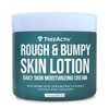 TreeActiv Rough and Bumpy Skin Lotion 8 fl oz, With Hyaluronic Acid, Shea Butter and Vitamin E, Nourishing Lotion for Rough and Bumpy Skin, Moisturizing Strawberry Legs Treatment, For All Skin Types