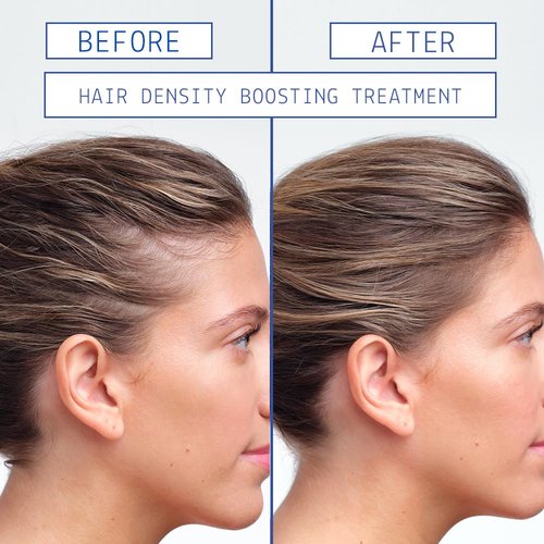 AAVRANI Mini Strengthening Hair Oil & Hair Growth Scalp Serum Gift Set - With Turmeric & Rosemary for Fuller Hair - Vegan, Travel Size