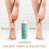 Foot Callus Remover Gel (6oz) - Calloused Feet Remover for Pedicure Supplies & Kit - Foot Peel Callus Shaver for Feet by Love Lori