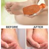 QUBA LINEN Pumice Stone for Feet - 2-Sided Terra Cotta Foot Scrubber, Professional Exfoliating Clay Stone for Feet Hands Body Care - Pumice Stone for Feet Callus Remover, Brown