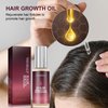 Hair Growth Serum with Castor Oil, Biotin, and Rosemary Oil - Hair Loss Treatment for Thicker, Longer, and Healthier Hair