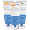 AcneFree Acne Clearing Mask, 3.5% Sulfur Acne Treatment, Absorbs Excess Oil and Unclogs Pores with Vitamin C, Bentonite, and Zinc, 1.7 Ounce - Pack of 3