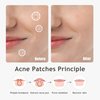 Dazzlook Hydrocolloid Pimple Patches, Day & Night Acne Patch with Salicylic Acid (48 Counts), Invisible Zit Patch, Invisible Spot Treatment Patch for Zit and Blemish, Absorbing Patch