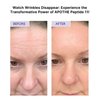 APOTHE Peptide 11 Botulinum Tension Up Repair Cream 50ml(1.69 fl.oz.)